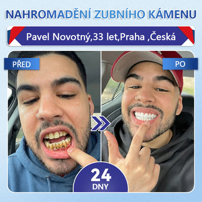Glimmerly® Tideglusib – rychle se rozpouštějící ústní proužky pro regeneraci zubů a dásní