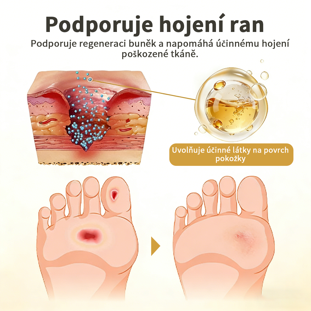 Hudros® 🧪 GlucaVeil 24H sprej na ochranu nohou 🥬