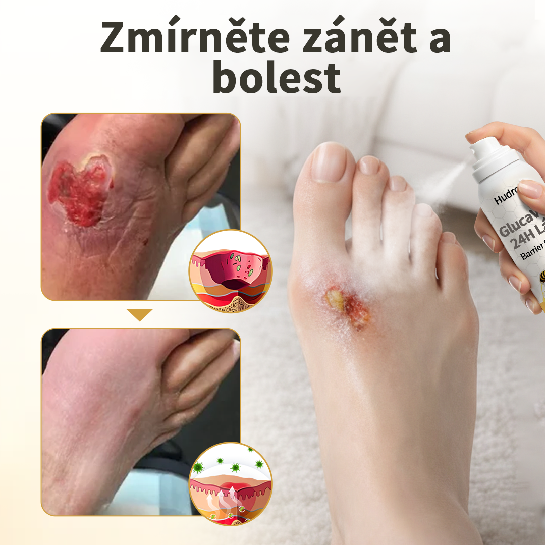 Hudros® 🧪 GlucaVeil 24H sprej na ochranu nohou 🥬