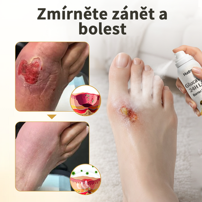 Hudros® 🧪 GlucaVeil 24H sprej na ochranu nohou 🥬