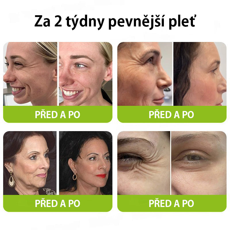 CleraNaure® Retinol Shot – Anti-aging sérum s botox-like peptidy | EU & CZ dermatologicky testováno