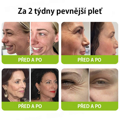 CleraNaure® Retinol Shot – Anti-aging sérum s botox-like peptidy | EU & CZ dermatologicky testováno