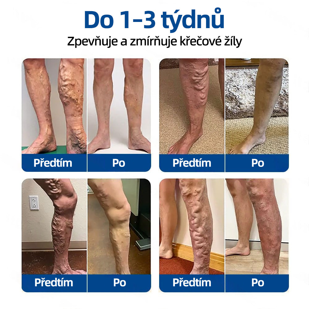 👩‍⚕️✅ 𝑯𝒆𝒂𝒍𝒓𝒊𝒛𝒆® 𝑽𝒆𝒊𝒏𝑻𝒂𝒓𝒈𝒆𝒕 𝒎𝒊𝒌𝒓𝒐𝒋𝒊𝒉𝒍𝒐𝒗á 𝒏á𝒑𝒍𝒂𝒔ť⚡ Okamžitá úľava, dlhodobé výsledky🌟