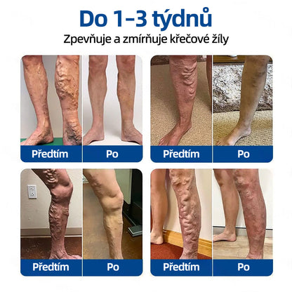 👩‍⚕️✅ 𝑯𝒆𝒂𝒍𝒓𝒊𝒛𝒆® 𝑽𝒆𝒊𝒏𝑻𝒂𝒓𝒈𝒆𝒕 𝒎𝒊𝒌𝒓𝒐𝒋𝒊𝒉𝒍𝒐𝒗á 𝒏á𝒑𝒍𝒂𝒔ť⚡ Okamžitá úľava, dlhodobé výsledky🌟