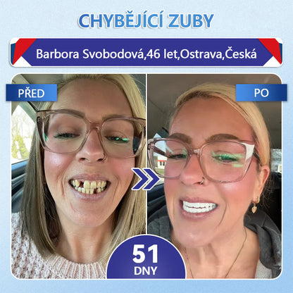 Glimmerly® Tideglusib – rychle se rozpouštějící ústní proužky pro regeneraci zubů a dásní
