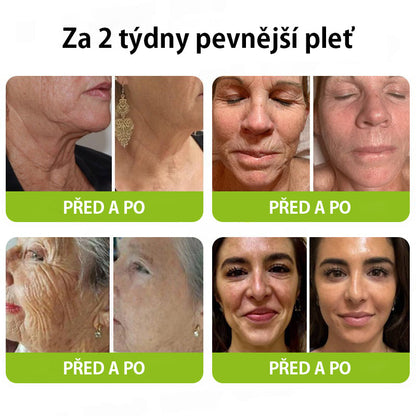 CleraNaure® Retinol Shot – Anti-aging sérum s botox-like peptidy | EU & CZ dermatologicky testováno