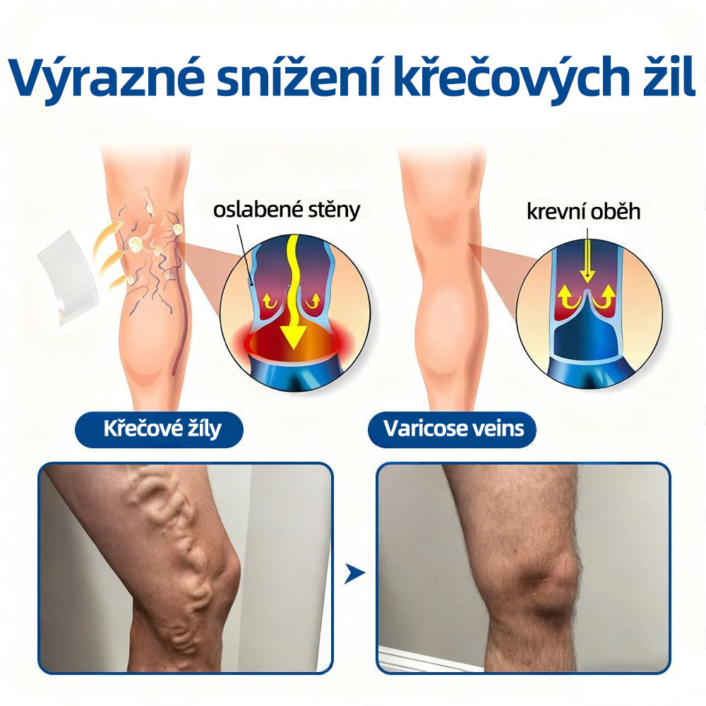 👩‍⚕️✅ 𝑯𝒆𝒂𝒍𝒓𝒊𝒛𝒆® 𝑽𝒆𝒊𝒏𝑻𝒂𝒓𝒈𝒆𝒕 𝒎𝒊𝒌𝒓𝒐𝒋𝒊𝒉𝒍𝒐𝒗á 𝒏á𝒑𝒍𝒂𝒔ť⚡ Okamžitá úľava, dlhodobé výsledky🌟