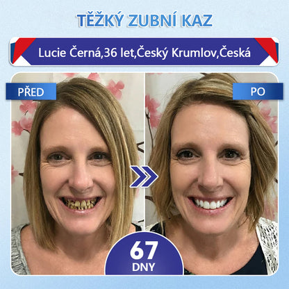 Glimmerly® Tideglusib – rychle se rozpouštějící ústní proužky pro regeneraci zubů a dásní