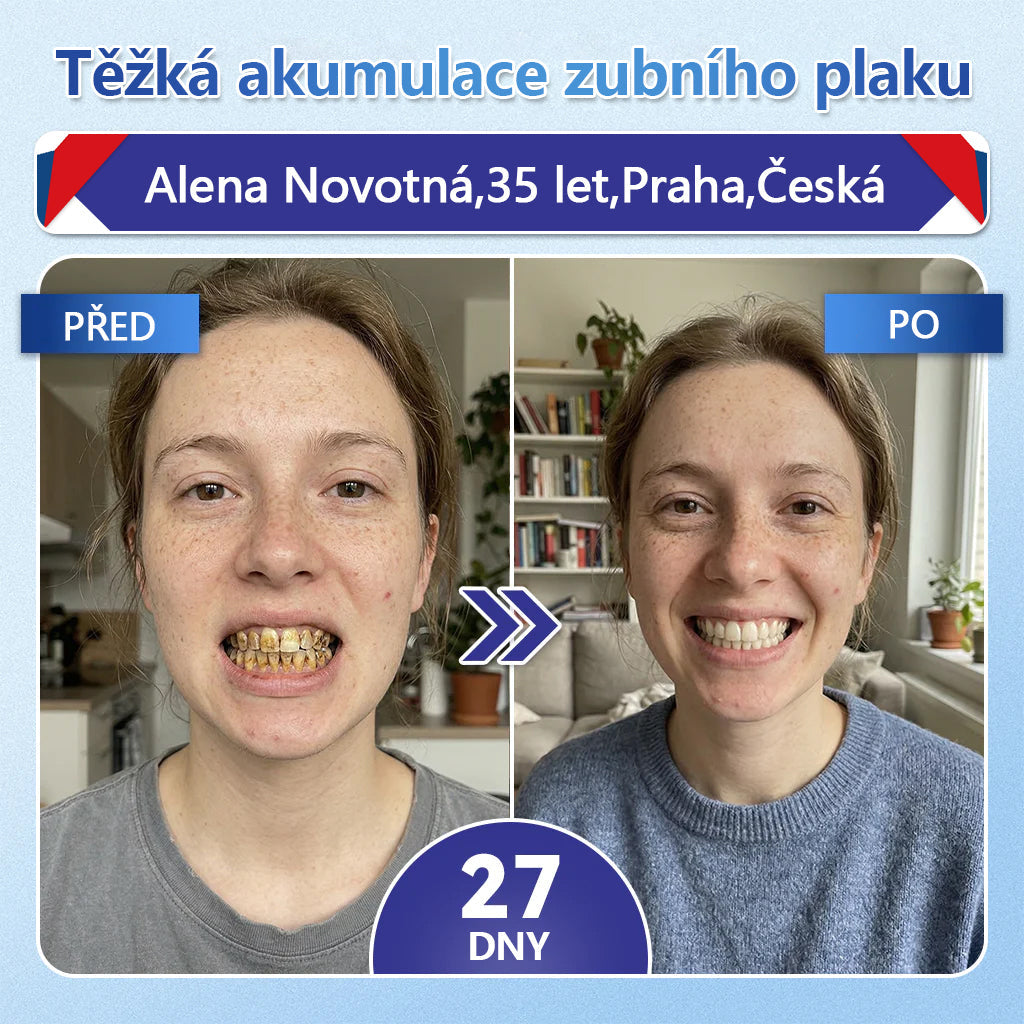 Glimmerly® Tideglusib – rychle se rozpouštějící ústní proužky pro regeneraci zubů a dásní