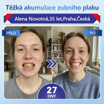 Glimmerly® Tideglusib – rychle se rozpouštějící ústní proužky pro regeneraci zubů a dásní