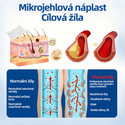 👩‍⚕️✅ 𝑯𝒆𝒂𝒍𝒓𝒊𝒛𝒆® 𝑽𝒆𝒊𝒏𝑻𝒂𝒓𝒈𝒆𝒕 𝒎𝒊𝒌𝒓𝒐𝒋𝒊𝒉𝒍𝒐𝒗á 𝒏á𝒑𝒍𝒂𝒔ť⚡ Okamžitá úľava, dlhodobé výsledky🌟