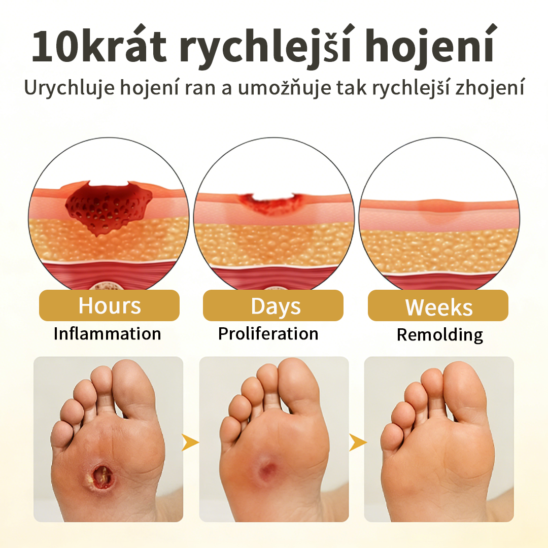 Hudros® 🧪 GlucaVeil 24H sprej na ochranu nohou 🥬