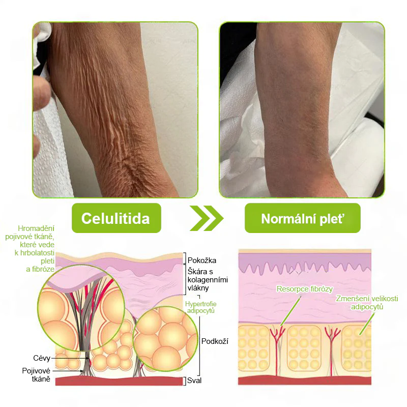 CleraNaure® Retinol Shot – Anti-aging sérum s botox-like peptidy | EU & CZ dermatologicky testováno